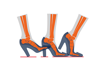 Foot Anatomy, Biomechanics and the High Heel